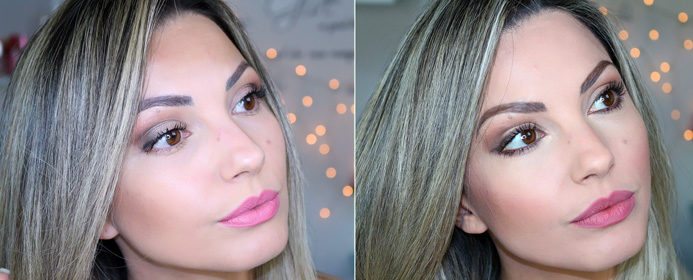 Tudo sobre meu botox: antes e depois, onde apliquei, etc